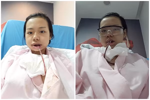 Bị bạn học trêu chọc là xấu xí, cô gái đợi đến 19 tuổi để phẫu thuật thẩm mỹ thành hot girl-2