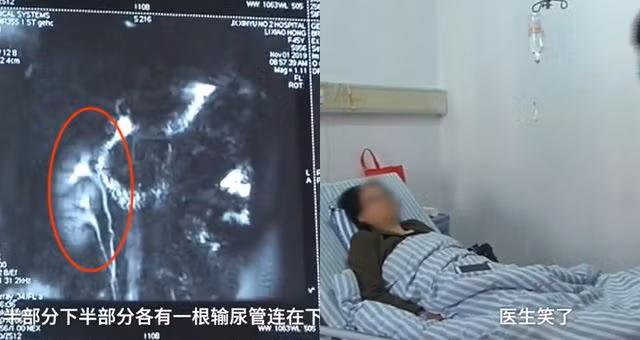 Người phụ nữ nhập viện trong tình trạng đau thắt lưng.