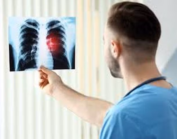 Nếu phát hiện được những dấu hiệu tổn thương phổi ở giai đoạn đầu, cần phải kịp thời đến bệnh viện để khám, có thể giảm thiểu tỉ lệ mắc bệnh ung thư phổi.