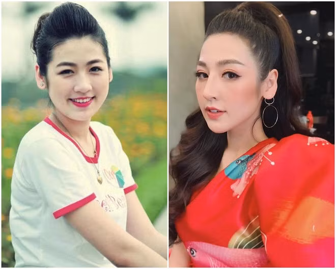 Xuất hiện với gương mặt khác lạ, Á hậu Tú Anh vướng nghi vấn phẫu thuật thẩm mỹ ảnh 1 Xuất hiện với gương mặt khác lạ, Á hậu Tú Anh vướng nghi vấn phẫu thuật thẩm mỹ