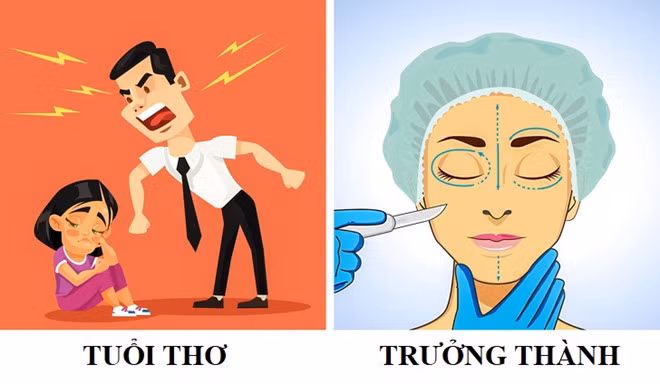 1. Không thể hiện tình yêu với con: Với trẻ em, bố mẹ là người quan trọng nhất. Nếu không cảm nhận được tình yêu từ cha mẹ, trẻ sẽ bị tổn thương, không yêu quý bản thân. Đây cũng là lý do nhiều người phẫu thuật thẩm mỹ để thay đổi ngoại hình. Nhưng ngược lại, nếu biểu hiện tình yêu thái quá đến mức kiểm soát gắt gao, cha mẹ lại khiến con trải qua tuổi thơ không hạnh phúc. 8 sai lam khi day con lam anh huong xau den tuong lai tre hinh anh 1