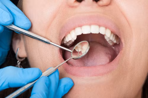 Vì sao cần khám răng trước khi phẫu thuật ung thư