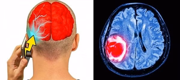 4 vị trí không nên đặt điện thoại nhưng nhiều người vẫn làm sai, gây nguy cơ vô sinh-1