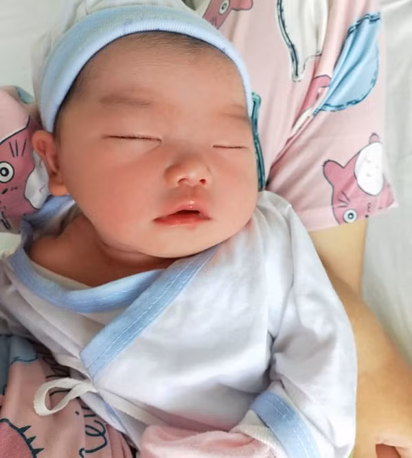 Em bé Bình Phước chào đời, bác sĩ nhìn vào miệng liền thốt lên đầy ngạc nhiên ảnh 3 em be binh phuoc chao doi, bac si nhin vao mieng lien thot len day ngac nhien - 4