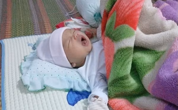 Em bé Bình Phước chào đời, bác sĩ nhìn vào miệng liền thốt lên đầy ngạc nhiên ảnh 2 em be binh phuoc chao doi, bac si nhin vao mieng lien thot len day ngac nhien - 3