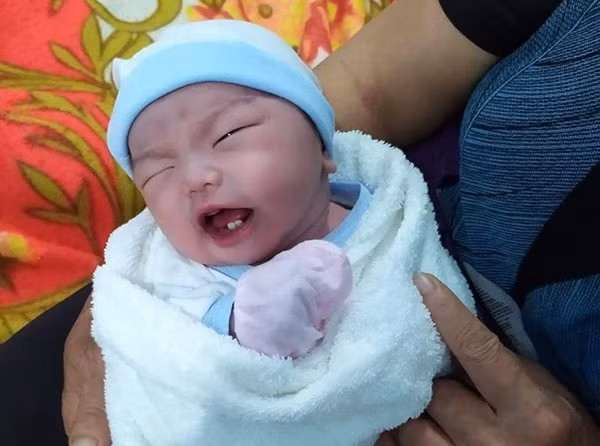 Em bé Bình Phước chào đời, bác sĩ nhìn vào miệng liền thốt lên đầy ngạc nhiên ảnh 1 em be binh phuoc chao doi, bac si nhin vao mieng lien thot len day ngac nhien - 1