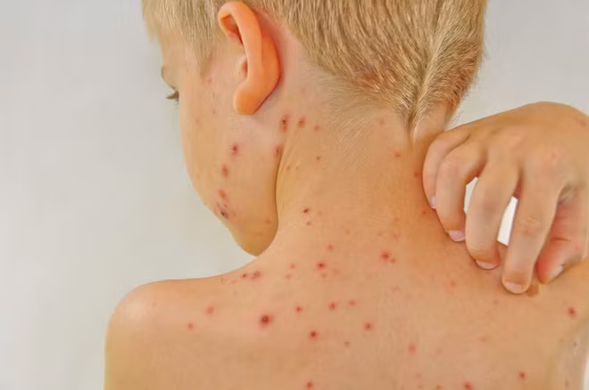 5 nhóm người không nên ăn cá để tránh gây hại lớn cho sức khỏe: Hãy xem có bạn không?-4