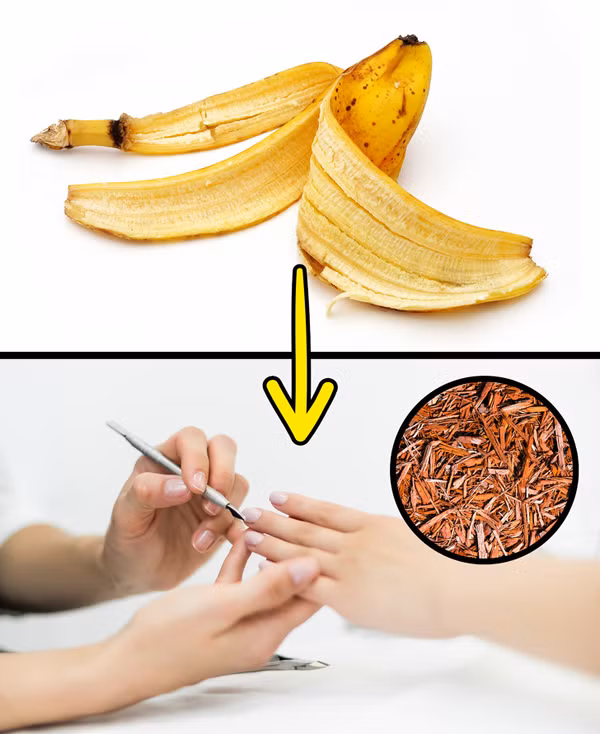 Giúp loại bỏ xước măng rô