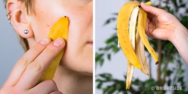 8 mẹo làm đẹp đơn giản với vỏ chuối không nhiều người biết - 2