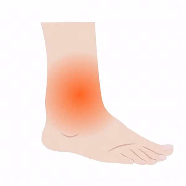 10 dấu hiệu cho thấy thận của bạn đang quá tải hoặc ngừng hoạt động-6