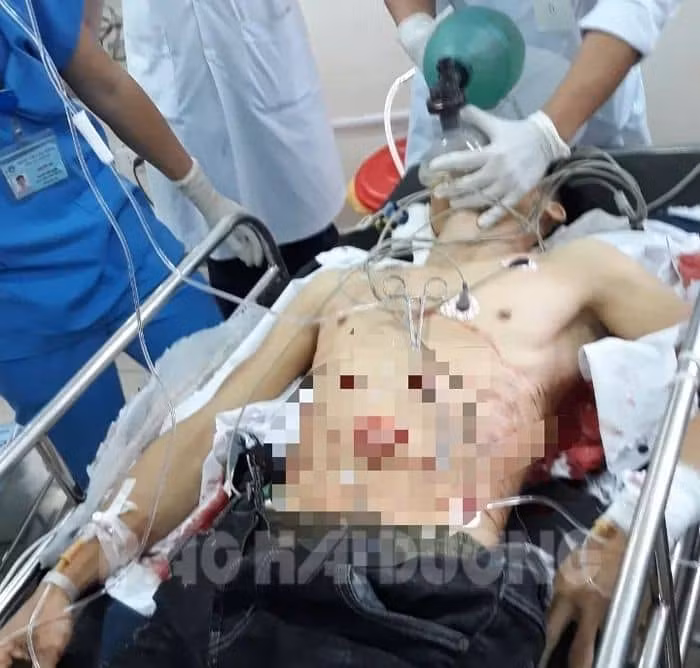 Chu Đăng Khoa đã tử vong vào tối 21.11 sau khi dùng dao tự đâm vào người mình ngày 14.11. (Ảnh: Báo Hải Dương).
