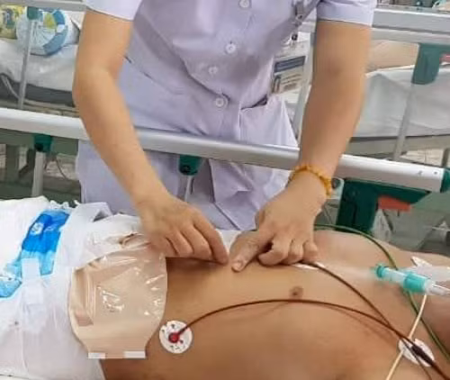 Báo động đỏ cứu bệnh nhân nguy cơ chết trên bàn mổ