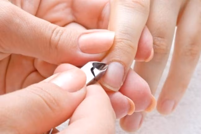 Nguyên nhân và cách trị xước móng rô đơn giản, hiệu quả Nguyen nhan va cach tri xuoc mong ro don gian, hieu qua