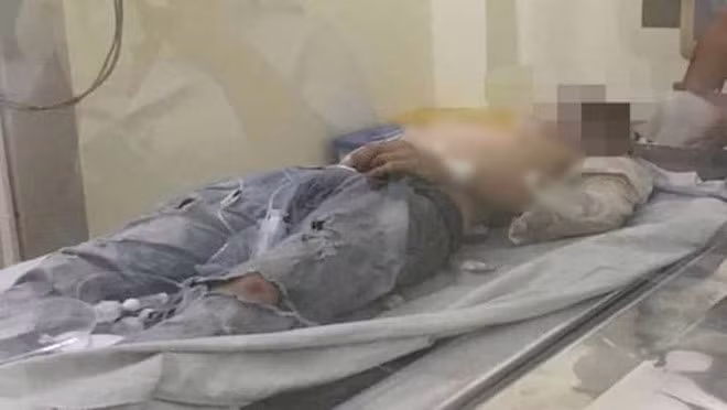 Nam nạn nhân đang được bác sĩ tích cực theo dõi, điều trị. Doi nam nu om nhau tu tu tren ghe da o lang dai hoc hinh anh 1