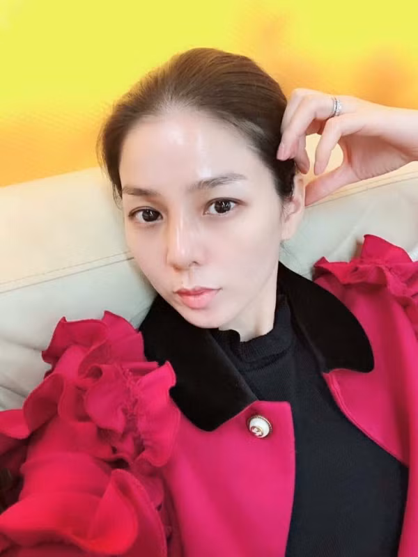 Hình ảnh Lệ Quyên với chiếc mũi đã tháo sụn được cô chia sẻ trên trang cá nhân. Lệ Quyên tháo sụn mũi gấp tránh hoại tử
