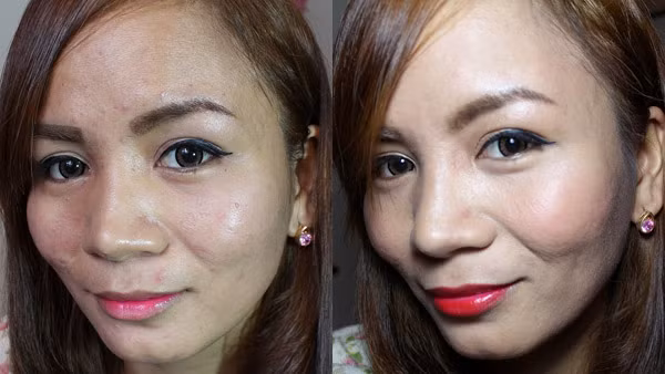 Kỹ năng trang điểm che mụn “thần thánh” khó tin ảnh 11 Kỹ năng trang điểm che mụn “thần thánh” khó tin ảnh 11