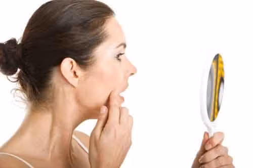 Mách bạn cách trị mụn trứng cá ở tuổi dậy thì nhanh khỏi nhất ảnh 2