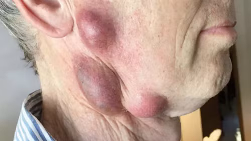 Ảnh: Nejm.org.