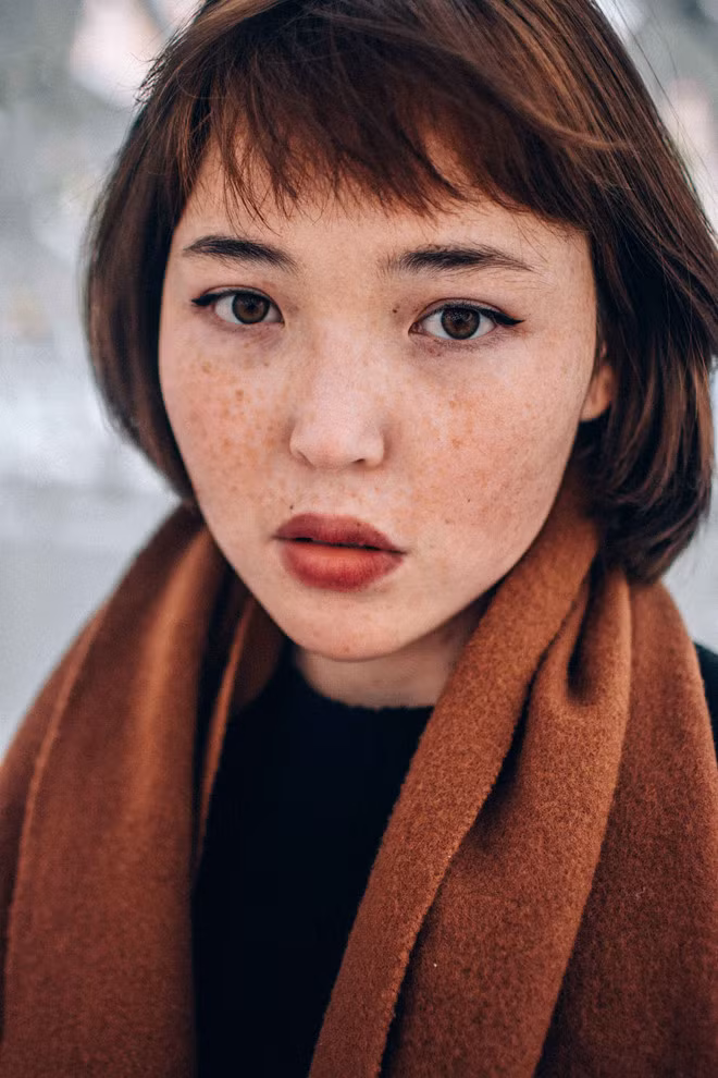Da thiếu vitamin E dễ bị nám và tàn nhang.Ảnh:Unsplash. Vitamin E va tac dung than ky trong viec lam dep da, chong lao hoa hinh anh 1