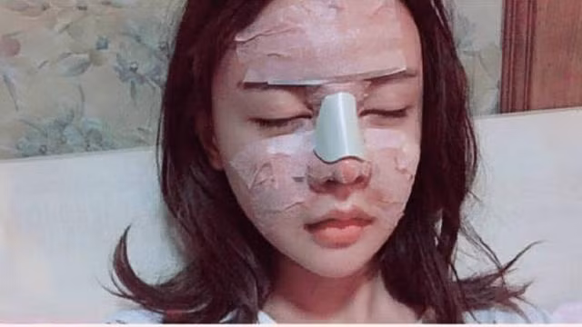 co gai trung quoc 20 tuoi phau thuat tham my tong cong 33 lan hinh anh 3