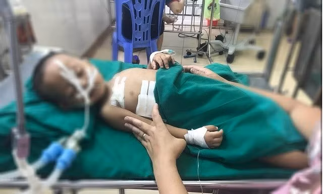 Bé trai 19 tháng tuổi nghịch súng bị đạn găm vào ngực