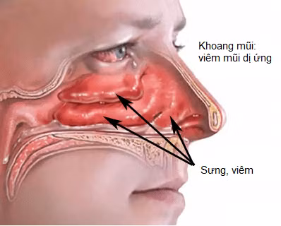 Mùa thu đông uống nước nóng - lợi ích lớn