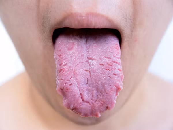 10 điều nên làm ngay để có hơi thở thơm tho ảnh 5