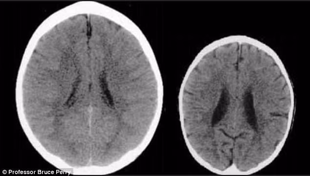 Những điều kỳ diệu về bộ não của trẻ mà không phải ai cũng biết - ảnh 4