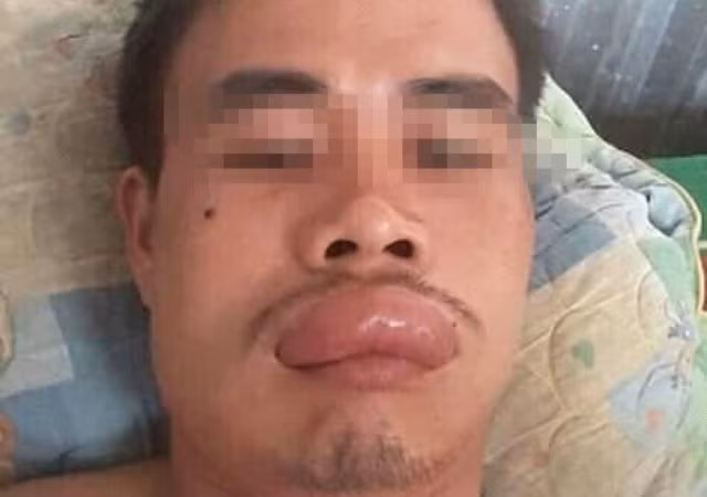 Thanh niên số nhọ nhất tối cuối năm: Đang ngắm hoa mai thì gặp hoạ