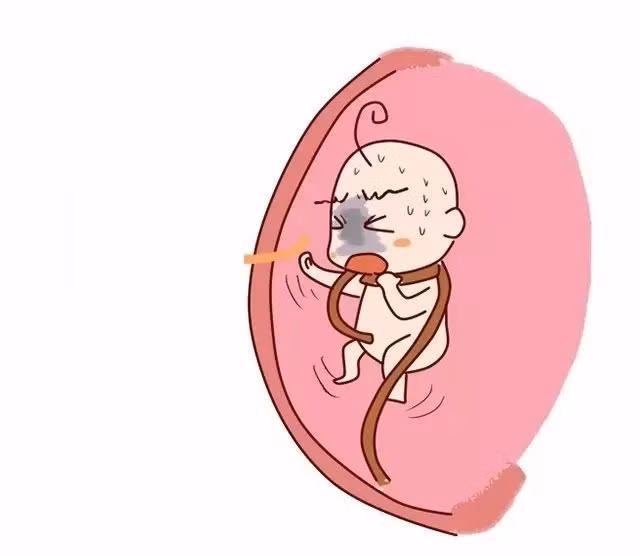 Mẹ đừng làm những việc này khi thai nhi bị dây rốn quấn cổ kẻo tình trạng nặng thêm