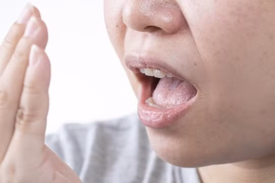 Hôi miệng, niêm mạc miệng nhợt nhạt cũng là tín hiệu cảnh báo về thận. (Ảnh: ITN)