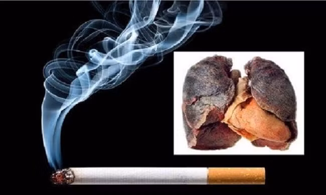 Hút thuốc lá có thể dẫn đến ung thư phổi. Ảnh: IT