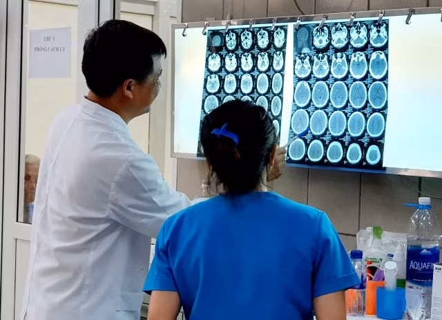 Phim chụp não bệnh nhân bị xuất huyết do ngộ độc ma túy đá.