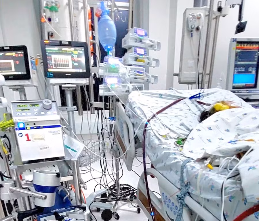 Bệnh nhi được can thiệp ECMO và thở máy tại bệnh viện. (Ảnh: BVCC)