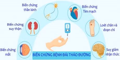 Ảnh minh họa.