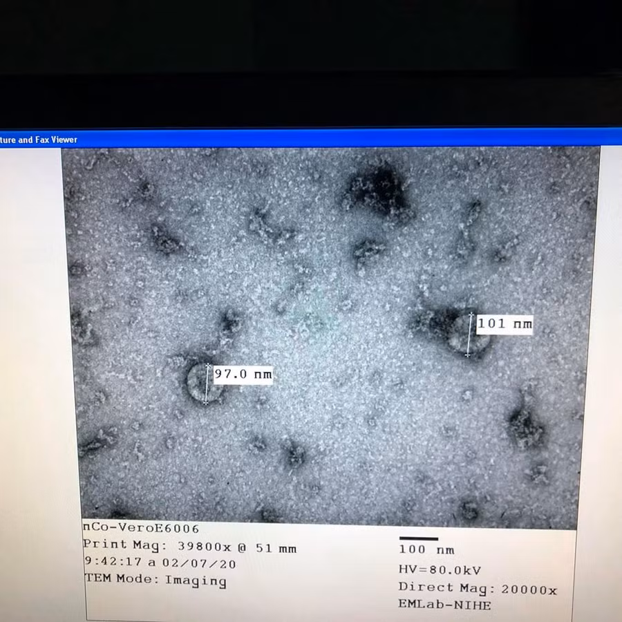 Việt Nam nuôi cấy và phân lập thành công virus corona mới