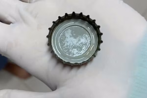 Nắp chai bia được các bác sĩ Bệnh viện Đa khoa Sóc Trăng gắp ra từ bụng ông T.