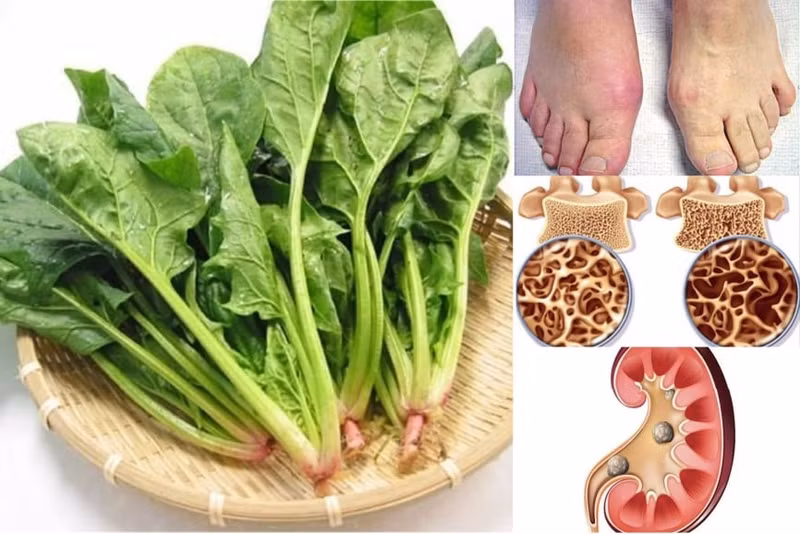 Cải bó xôi (rau bina) là lựa chọn giàu dinh dưỡng, ít calo dành cho người bị đái tháo đường. Loại rau vừa rẻ, tốt cho người tiểu đường, chợ Việt bán nhiều