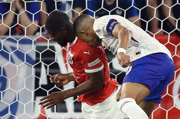 Chùm ảnh: Mbappe gãy xương mũi, phải đeo mặt nạ ở EURO 2024 