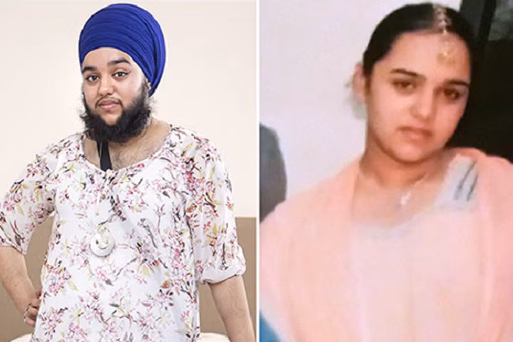 Harnaam Kaur trước và sau khi nuôi râu. Ảnh: Mirror