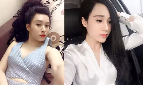 Loi khuyen gui chi em cua co gai Ha Noi vua tham my xong lai chiu dau de go het don cam, thao mui, nao silicon o moi - Anh 6