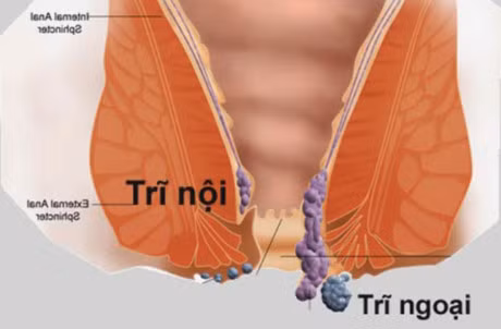 Meo chua benh tri tai nha - Anh 1
