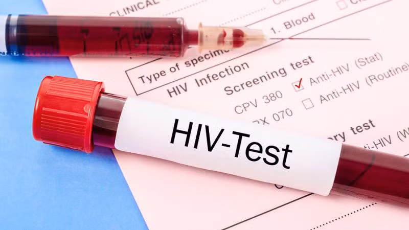 hiv.jpg