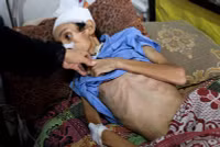 chum-anh-nan-doi-ngay-cang-nghiem-trong-o-dai-gaza-0705-02.jpg