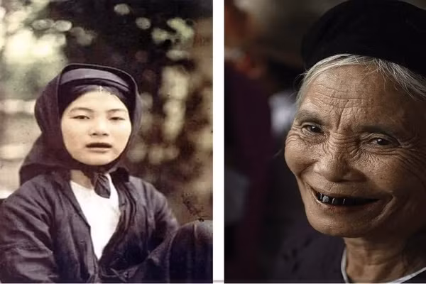 Phụ nữ Việt Nam với hàm răng đen. 