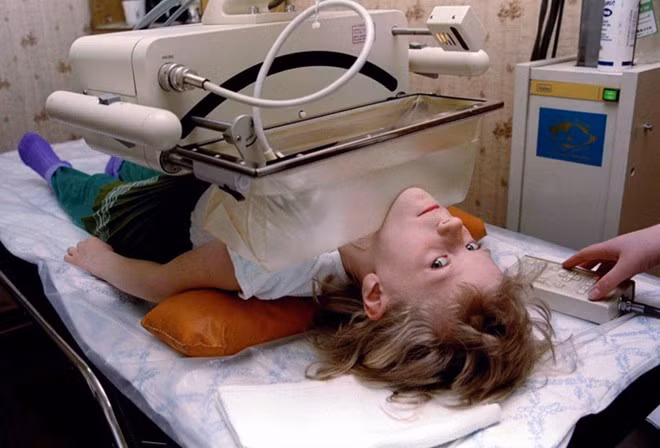 Olga Derzhutskaya, 6 tuổi, trải qua ca phẫu thuật ung thư tuyến giáp ở Gomel, Belarus. Phụ huynh của em nhiễm chất phóng xạ từ thảm họa Chernobyl và truyền sang Derzhutskaya. Ảnh: RT 1