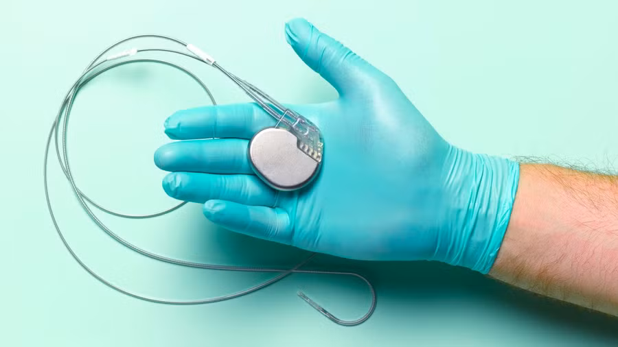 Tim cấy ghép - có thể bao gồm máy điều hòa nhịp tim - nằm trong số những cấy ghép y tế được lấy từ bệnh nhân đã qua đời và được tái sử dụng.