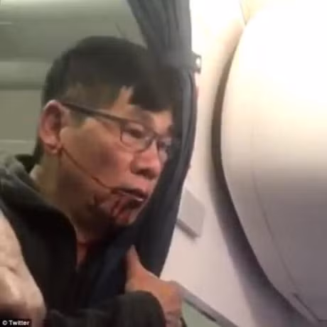 Vu kien United Airlines se tro thanh 