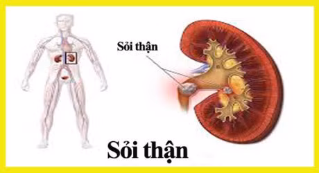 Soi than: Can benh nguy hiem khong chua mot ai - Anh 1