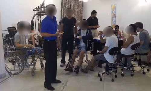 Bệnh nhân đang điều trị phục hồi sau khi kéo dài chân. Ảnh: Bác sĩ Sarin khat-vong-chan-dai-cua-thanh-nien-an-do-1